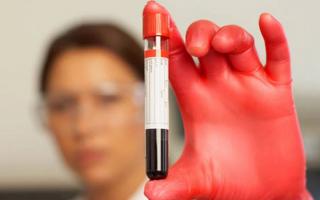Progesteron u krvi: kako, zašto i kada donirati?