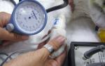 Normaler Blutdruck bei einer Katze und wie man ihn misst Wie man hohen Blutdruck bei einer Katze bestimmt