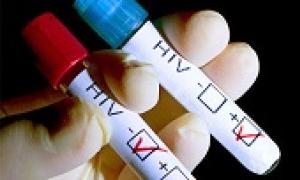 Analýza HIV pomocou ELISA: presnosť, spoľahlivosť